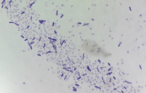 Clostridium chauvoei - AB's Veterinary Microbiology